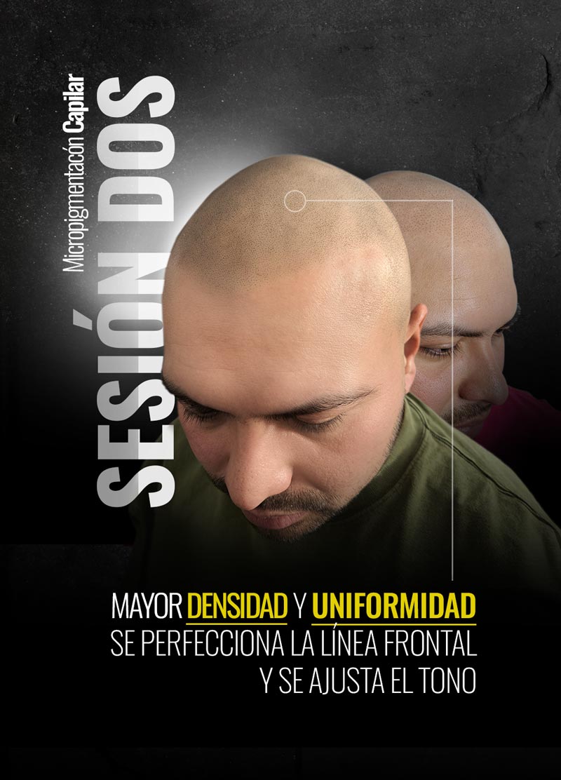 Sesion-Dos-AlfaNovo_V1