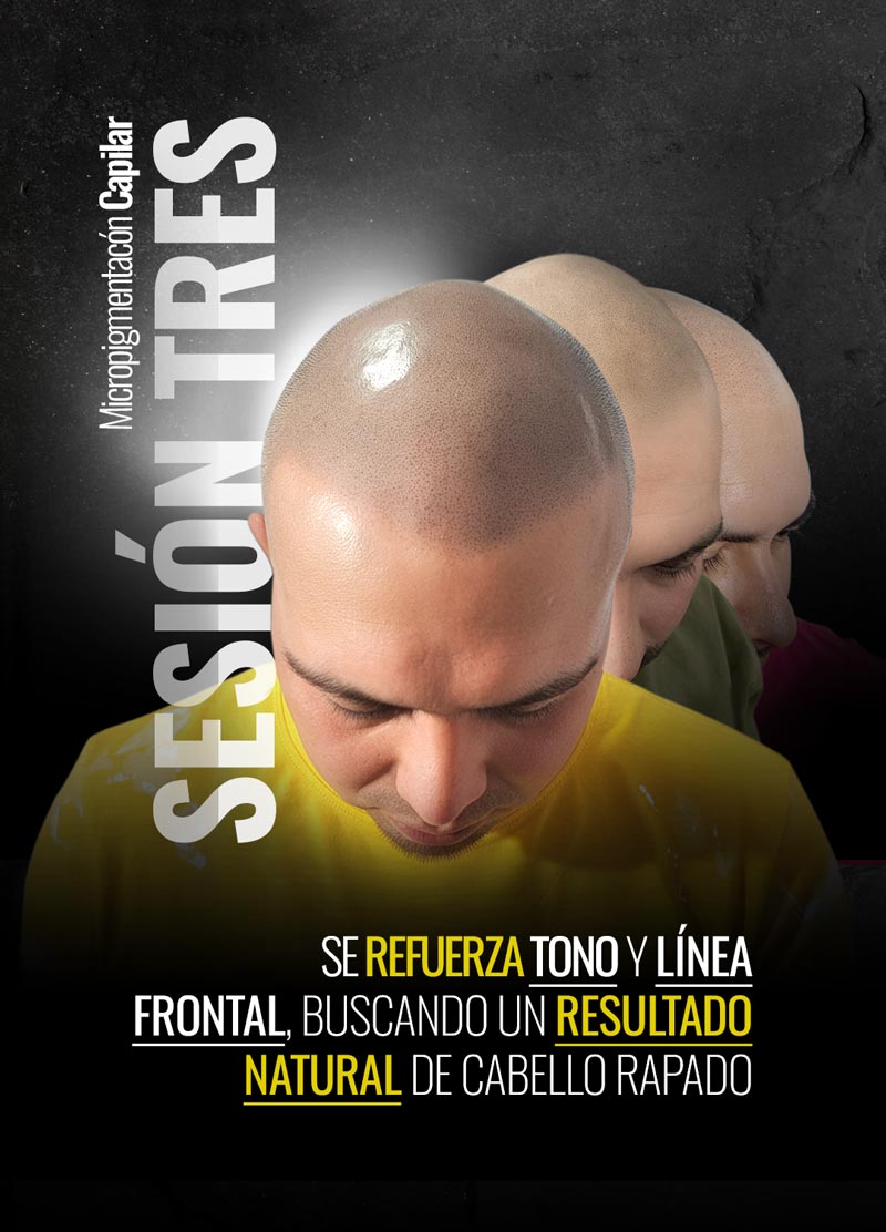 Sesion-Tres-AlfaNovo